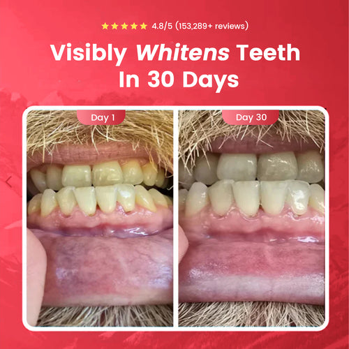 Astraglow hydroxyapatite & Probiotic Proper Toothpaste,Healthy Whitening