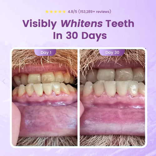 Astraglow Hydroxyapatite Toothpaste Relieves Sensitivity, Protects Enamel, Whitens