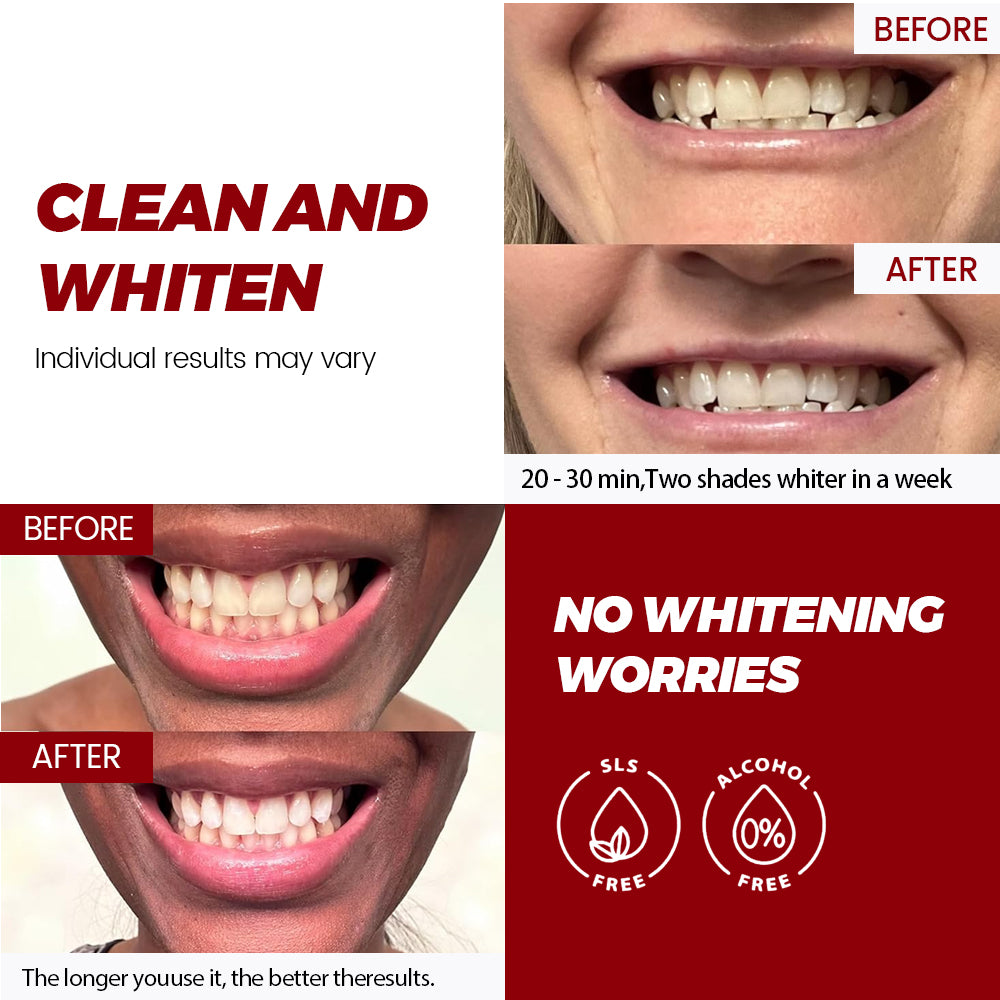 TEETH WHITENING STRIPS