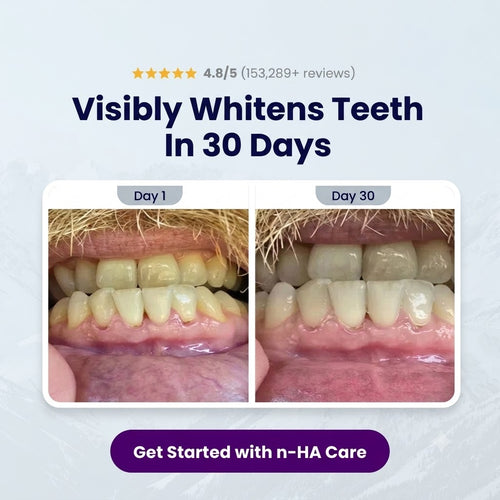 Gentle Fix Toothpaste with 8% NHAP,Advanced Oral Care Plan